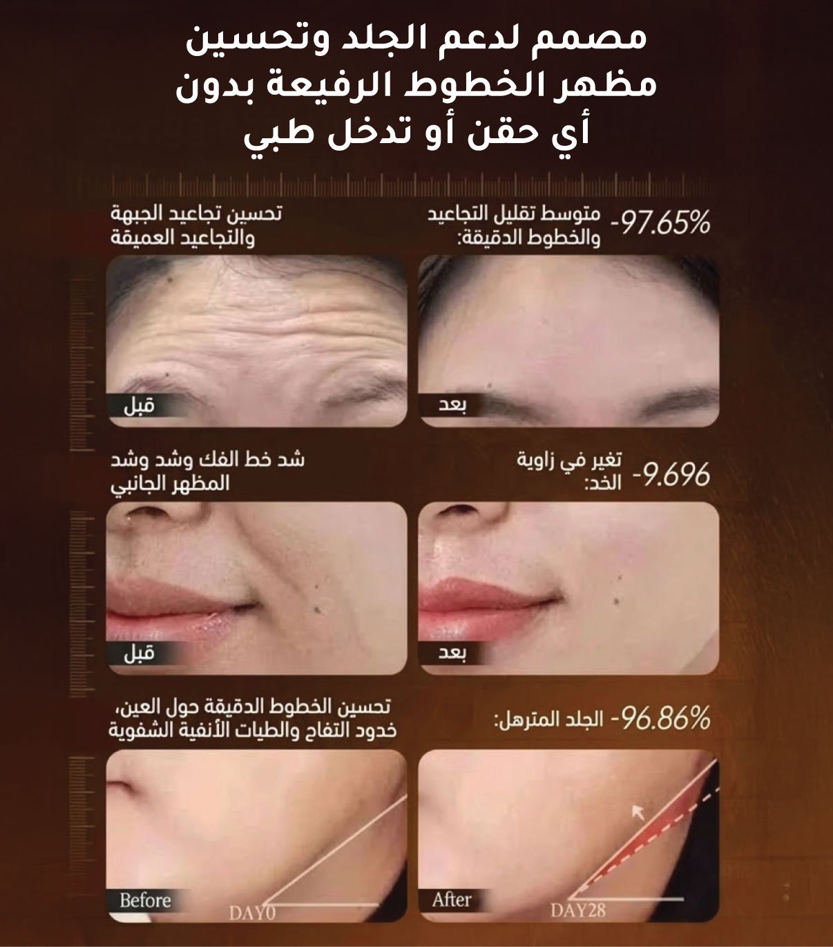 يسىيسيساتيستايستايسات.jpg